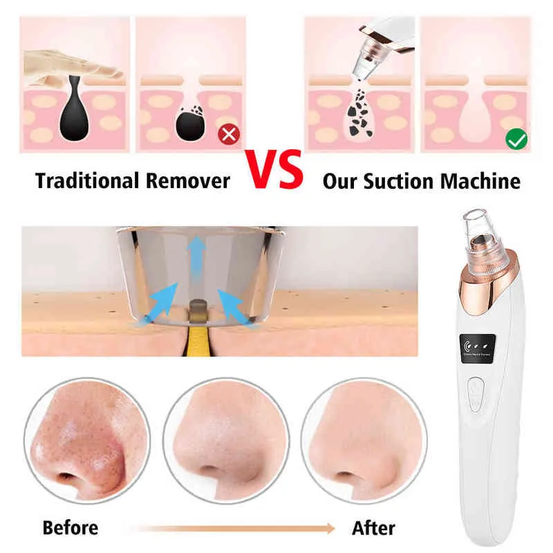 Ansiktsvårdsenheter Blackhead Remover Vakuum Porrengörare Ansiktsrengöring Svarta prickar Sug Exfolierande skönhet Acne Pimple Tool Skin 0727