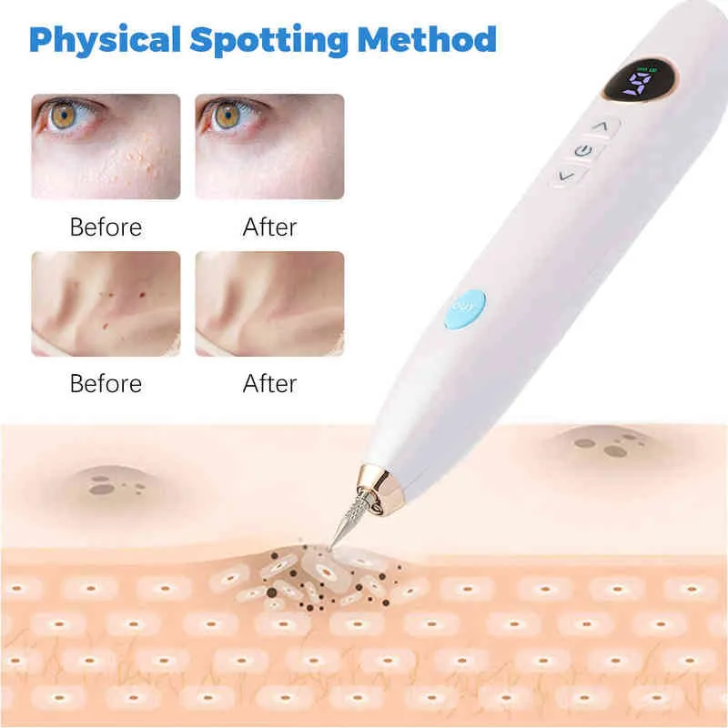 Skin Tag Remover Verrue Berrugas Eliminator LCD Plasma Stylo Papillomas Électrique Laser Enlèvement Tache de rousseur Dark Spot Mole Cauterizer Kit 211231