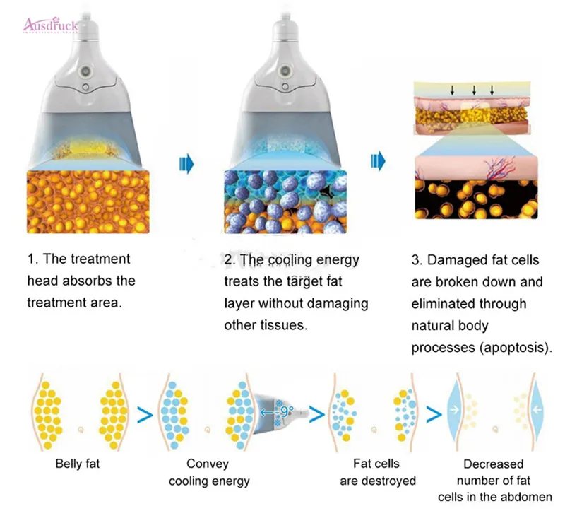 Новейшие настольные 360 градусов холодного охлаждения Tech Cryo Cryootherapy Cool Lipolysez жир замерзливая тело для похудения скульптурные потери веса машина CE