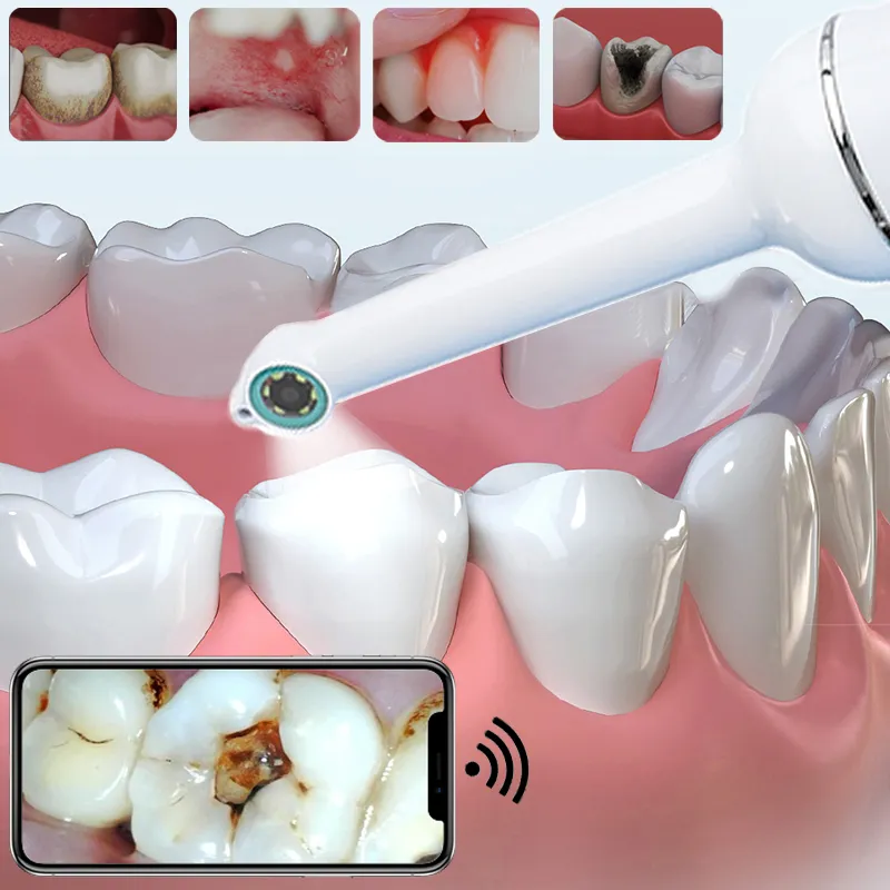 Caméra d'inspection des dents de la bouche sans fil WiFi dentisterie caméra dentaire intra-orale moniteur dent endoscope intra-oral avec lumière LED