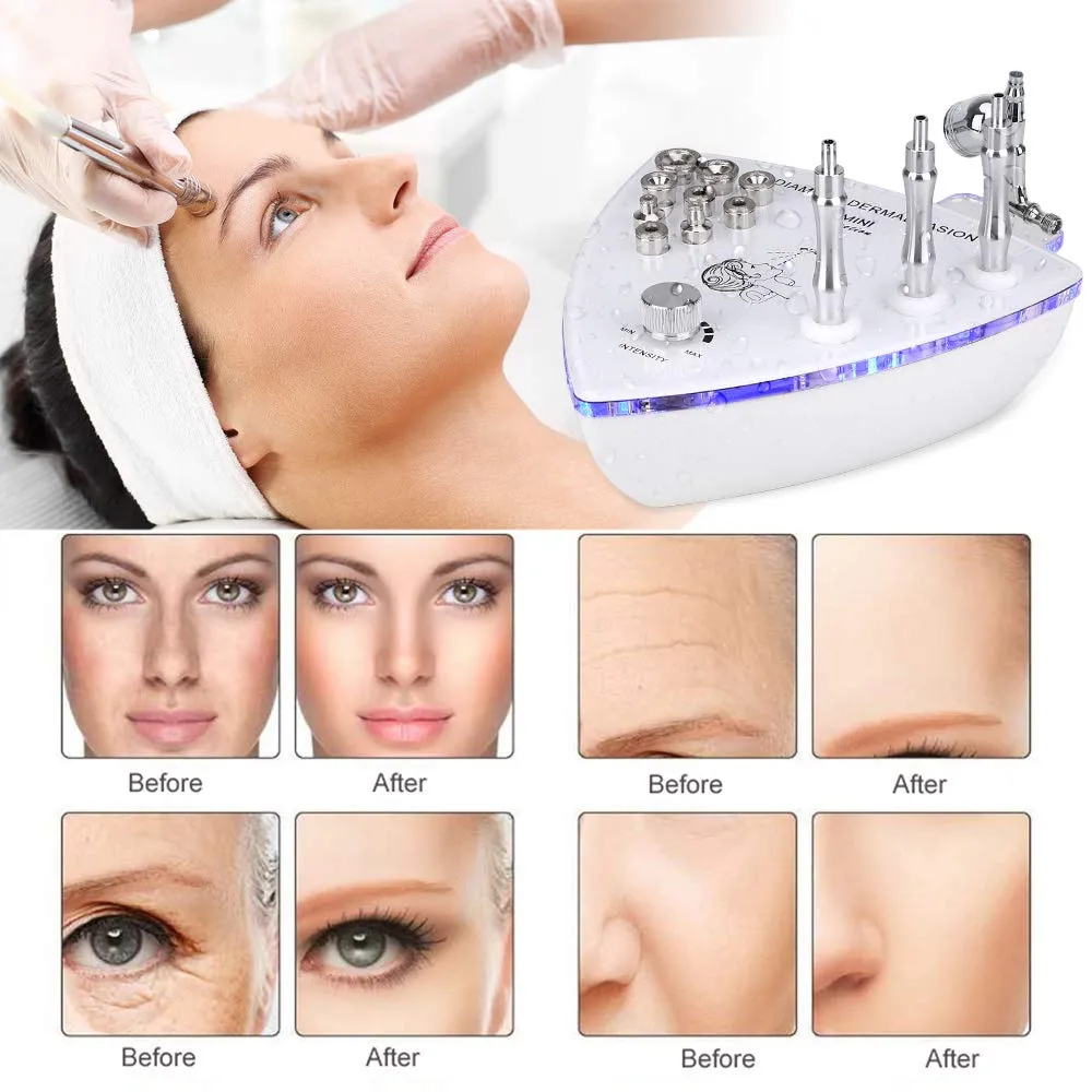 Diamond Microdermabrasion Dermabrasion Machine Facial Beauty Vacuum Spray Suction Vacuum Suction Exfoliation Facial Massage