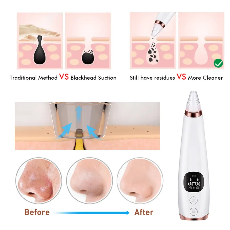 Blackhead Remover Vacuum Sug Cleaner Nose Pore Spot Acne Black Head Pimple Removal Beauty Face Skin Care Tool 26