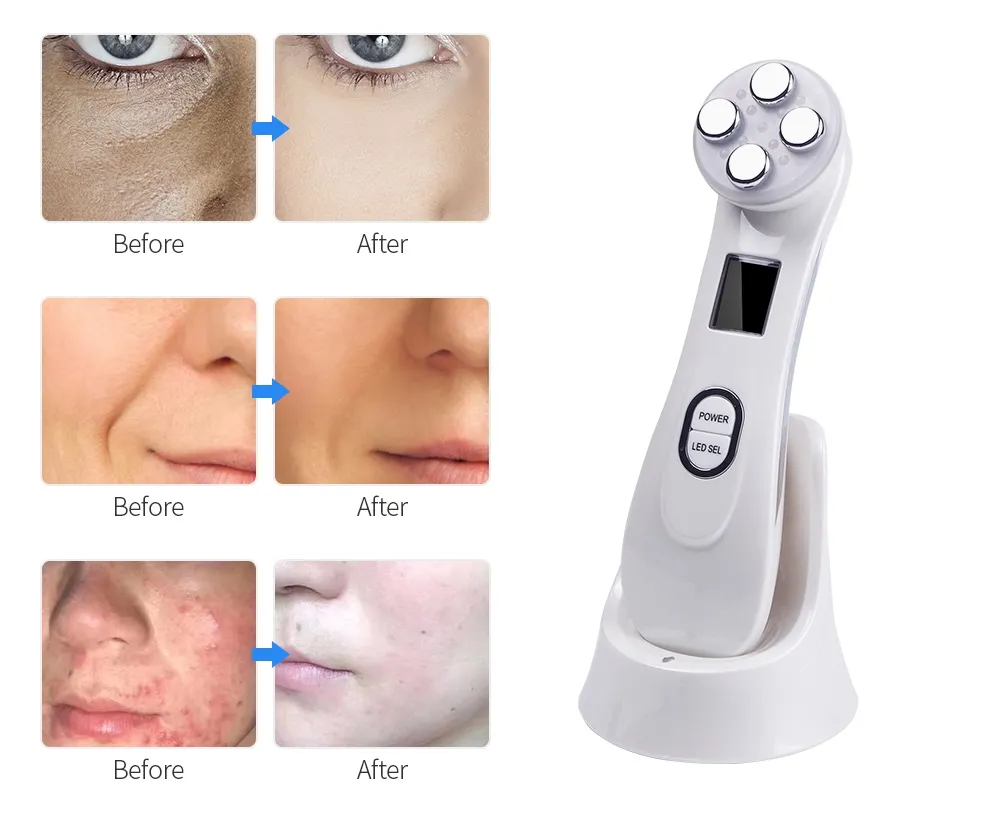 Mesoterapia facial eletroporação rf radiofrequência led pon cuidados com a pele dispositivo de beleza face lifting apertar remoção de rugas 2501867