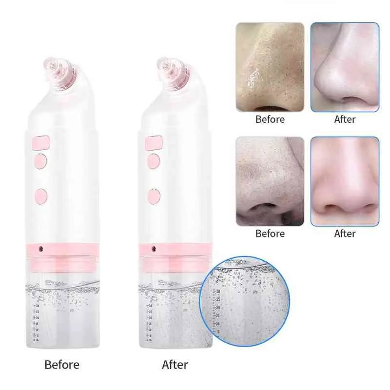 Sucção de vácuo bolhas faciais com ciclo de água Limpeza de poros profunda Cravo de remoção de óleo de remoção de óleo Cuidado com oxigênio Ferramentas de cuidados faciais 220514
