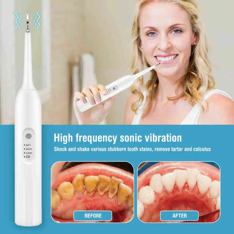 فرشاة الأسنان صوتية أسنان أسنان أسنان الأسنان تبييض التنظيف لحساب التفاضل والتكامل التارتار مزيل USB الموجات فوق الصوتية منظف الأسنان عن طريق الفم 0511