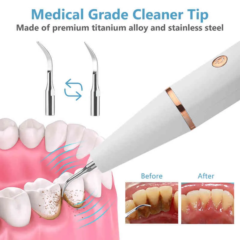NXY Escova de dentes Ultra Dental Cleaner Dental Calculus Scaler Elétrico Oral Dentes Removedor de Tártaro Placa Manchas Limpador Branqueador de Dentes 04095198333