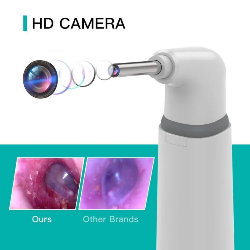 3.9mm WIFI Otoscopio digitale visivo Otoscopio auricolare Fotocamera Detergente cera naso Supporto dentale IOS Android 220722
