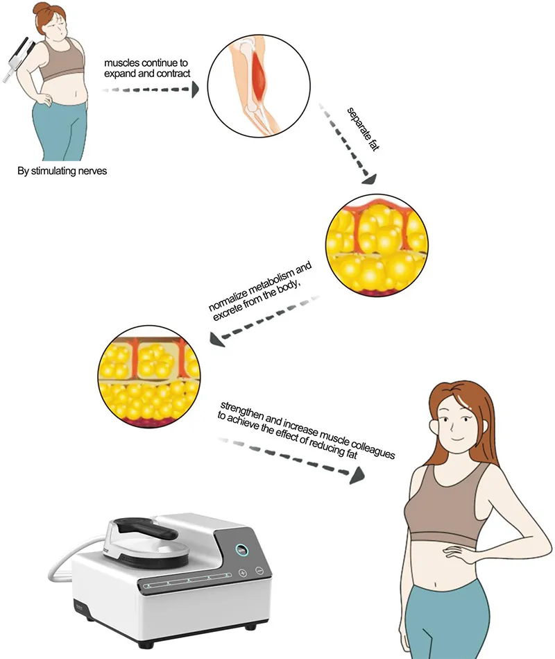 EMS ABS abdominal muskeltränare elektromagnetisk kropp bantning muskelstimulator massage maskin