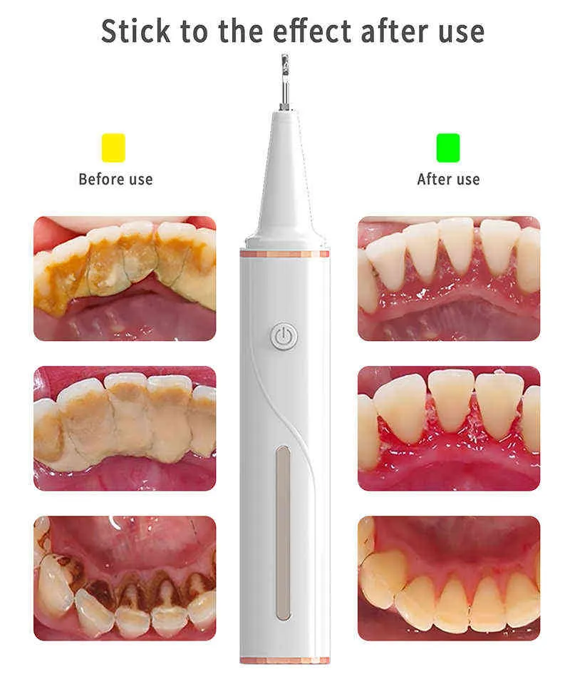 Justlang Irrigator Dental Visible WiFi Ultrasonic Tooth Cleaner Whitening電気水フロッサージェット計算除去220510