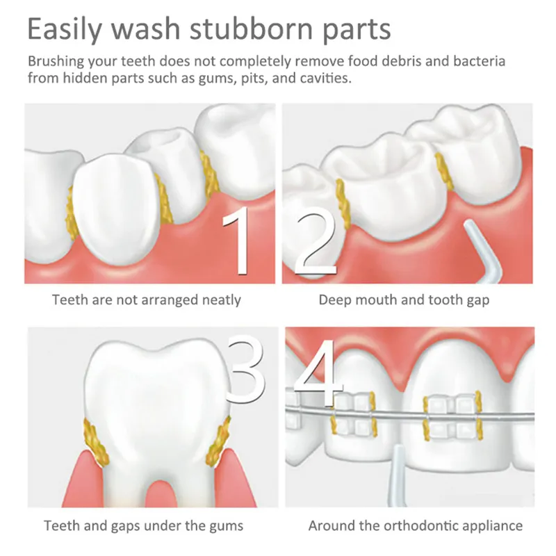 Dental Cleaning Plack Borttagning Tartar Eliminator Jet Washing Teeth Flosser Oral Irrigator Tandpetare Vattentryckrengörare 220513