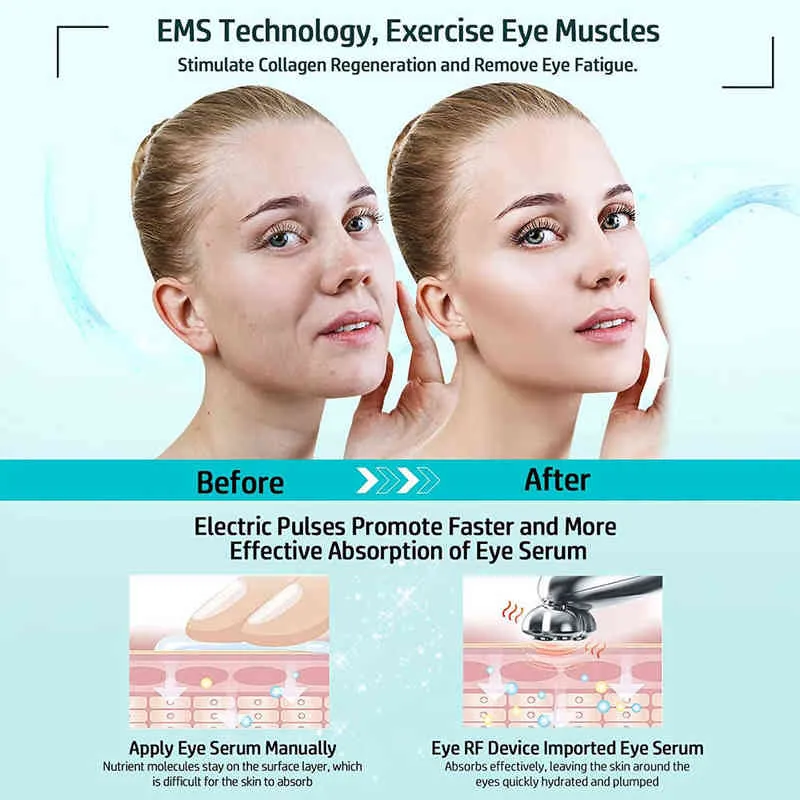 Микротоколонное лицевое устройство радиочастотная радиочастотная кожа глаз, стесняющая анти старения, уменьшает морщины, поднявшие глаза Massager2207928614