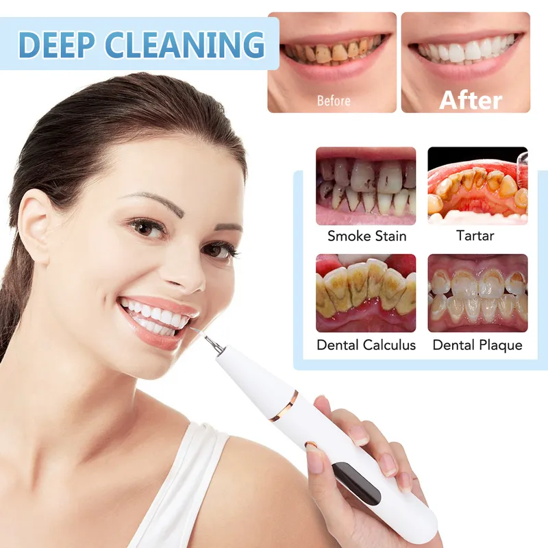 Cálculo dental ultrassônico dentes orais de dentes orais Remover tártaro manchas de placa Remova Remova Branqueamento 220727