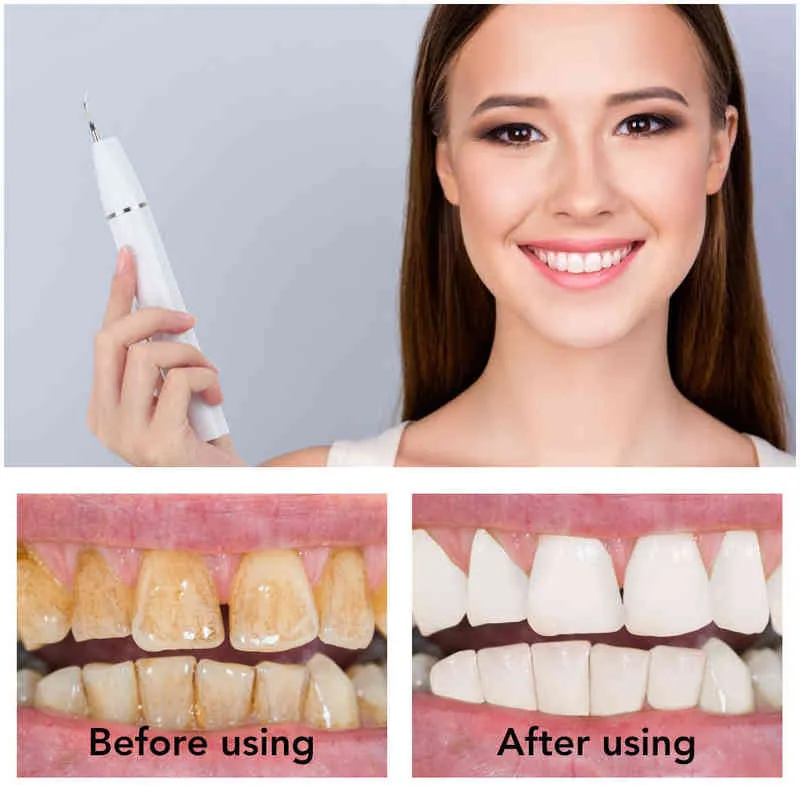 Wizualna ultradźwiękowa skaler dentystyczny Rachunek doustny doustny zębata plamera czyszcząca zęby LED wybielanie narzędzia czyszczenia 220513