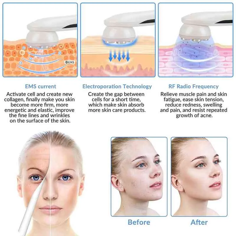 EMS LED Photon Massager Mesoterapia Eletroporação RF Radiofrequência Facial Cuidado da pele Dispositivo Face Face Tinter Beauty Machine 220512