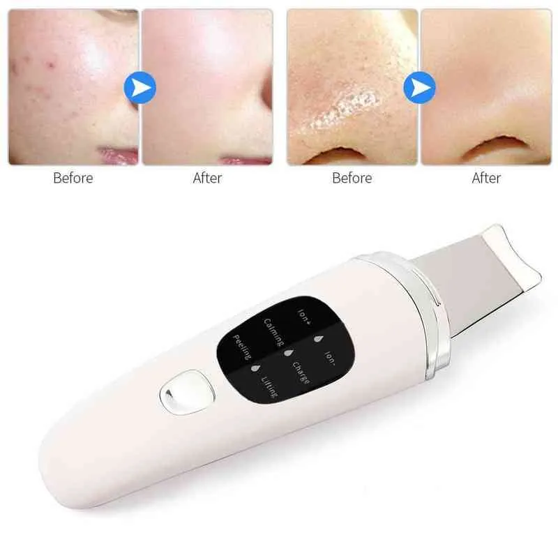 Ultrasonic Skin Scrubber Atomized Vibration Deep Exfoliation Remove Blackhead Acne Facial Peeling Device Pore Cleaning Shovel 220514