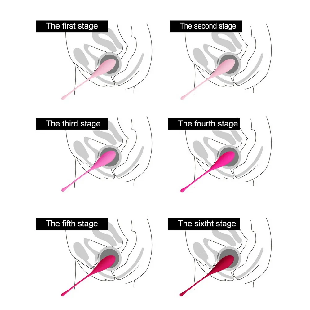 ikoky 6 قطع الحب بن وا الكرة المهبل تشديد مدلك سيليكون كيجل الذكية المدرب ممارسة مثير لعب للنساء