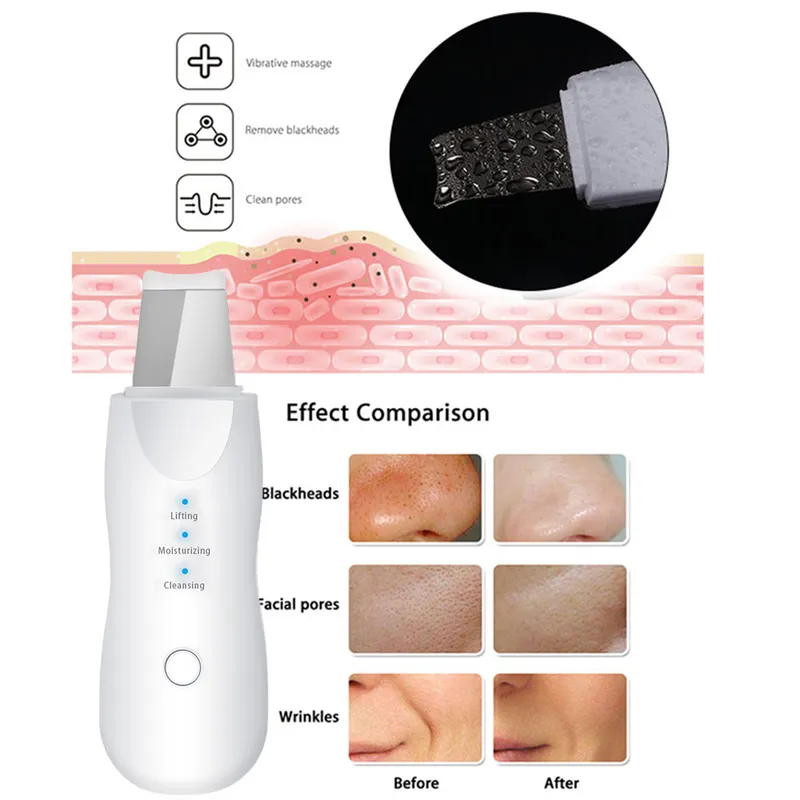 EMS R Frequency RF Blackhead Remover Skin Scrubber Infrared Body Slimming Massager Cavitacion Galvanica Cleaning Face Beauty 220620
