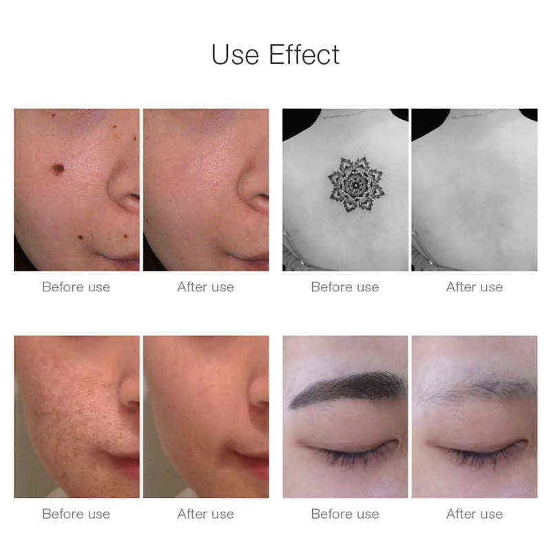 Dispositivos de cuidados com o rosto portátil mini vermelho azul azul laser laser picossegund caneta preta de tatuagem de tatuagem acne scar scar sardent spot spot spot pigment 0727