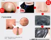 2017 Hot Pilaten Facial Minerals Conk Nose Blackhead Remover Mask Pore Cleanser Nose Black Head Ex Pore Strip