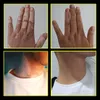 vitiligo 컨실러 액체 펜 방수 vitiligo 패치 천연 숨기기 백혈병 인스턴트 메이크업 피부 질병에 대한 솔루션 3643786