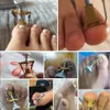 Corrector de unha encravada Toe Pedicure Ferramentas de cuidados com as unhas de aço inoxidável Tratamento de pedicure Onyxis Bunion Correction Tool