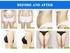 Newest Cryolipolysis fat burning equipment cellulite treatment machine with muscle stimulate function for weight loss with 4 handles