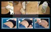 Liposonix 슬리밍 기계 가격 셀룰 라이트 제거 홈 살롱 스파 사용 HIFU 기계 Lipohifu 초음파 리포소닉 장비