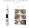 Professional Fibroblast Eyelid lift face skin lift Plasma Pen Wrinkle spot mole removal plasmapen with light and High Quality Beau5956714