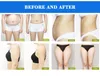 Vela Roller Slimming Cavitation脂肪損失ボディシェイプ真空RFレーザーフェイスリフティングスキンファイヤーマシン