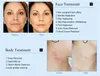 Estrabas de eliminaci￳n de estr￭as estacionarias / Rejuvenecimiento de la piel RF Facial de radiofrecuencia Fraccionional Fraccionional Microfrecuencia
