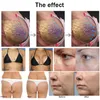 5 IN 1 Breast Enlargement Machine Nipple Lifting For Home Use Breast Enhance Massager rf radio frequency cellulite removal machine