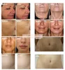 Przenośne frakcyjne RF Machine Machine Facial Lift Gold Micro Igła Igła Blizna Stretch Mark Usuwanie Usuwanie Oczyszczania DHL Statek