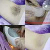 OPT Handle for laser hair removal Accessories Elight skin rejuvenation OPT IPL machine more than 300000 shots