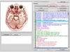 その他のヘルスケアアイテムBioresonance NLS Bioplasm 8D -LRISボディスキャナーマシン-Aura Chakra Healing