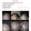 Hair Regrowth 276 Diodes 650nm Cap de laser Perte anti-cheveux Matériel de traitement de la croissance Lazer Croissance