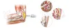 preço de fábrica SW5S Shockwave Terapia beleza máquina Shock Wave tecido dor Destruição Diminuir fisioterapia gainswave ED eréctil dysfunct