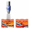 전신 마사지 효과적인 음향 충격파 치료 기계 기능 통증 제거 ED 치료를위한 통증 제거