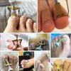 Pedicure Nail Bunion Corrector Manicure Foot Care Tools Cure Curl Embedded Toenails Caused Orthopedic Paronychia Onychomycosis