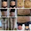 Fettfrysning Kroppsbantning Feze Fat RF Skin Föryngringssystem 7 i 1 Fett Freeze Vacuum Cavitation Lipo Laser Machine