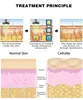 635NM-650NM Anti-Cellute Lipo Laser RF LLLT 8 PADS SLIMING STRATUJSKA Strata tłuszczowa Maszyna piękności