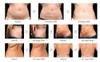 2021 Liposonix Hifu Slimming Machine Face Lifting Ultraljud Body Fat Wrinkle Avlägsnande Hud Åtdragning Skönhetsutrustning