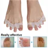 Meetcare Hallux Valgus Correction Bretelles Séparateur D'orteils Qui Se Chevauchent Traitement De Réadaptation Pied Os Orthèse Orthèse Soins Des Pieds