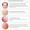 آلة إزالة الأوردة العنكبوت 980nm ليزر العلاج الوعائي الأوعية الدموية remova Lazer Rosacea Redness Redness Treatment