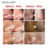 SACE LADY Maschera per la rimozione di comedone Strisce nasali Testa nera Naso Dot Spot Peel Off Sticker Viso Acne Detergente per pori