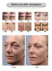 profissional 3D 4D HIFU 12 linhas 20000 Shots High Intensity Focused Ultrasound HIFU Face Lift máquina rugas remoção do corpo de emagrecimento Navio DHL