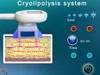 기계 Tingmay 휴대용 한 Cryolipolysis 슬리밍 기계 냉동 2020의 새로운 트렌드 고품질 차가운 지방