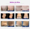 5 i 1 Skönhetsanordning Multipolär bipolär RF Laser Face Care Body Form Celluliter Avlägsnande Vakuum 40K Cavitation Slimming Machine Spa