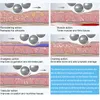 Verticale lichaam afslankmassage machine binnenste bal rollen Vet verwijdering huidverstrakking cellulitisreductie