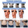 High intensity EMT Technology Slimming Fat Removal Machine Muscle Stimulator Body Shaping EMSLIM Equipment