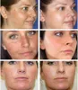 Whitening Freckle CreamMelasma Acne Spot Pigment Melanin Dark Spots Remover Skin Care